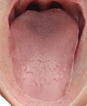 saubere Zunge