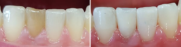 014Bleaching8954.jpg