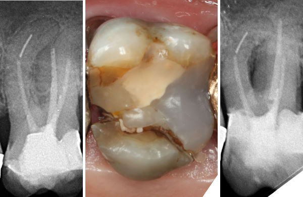C1Spaltbildung8811.jpg