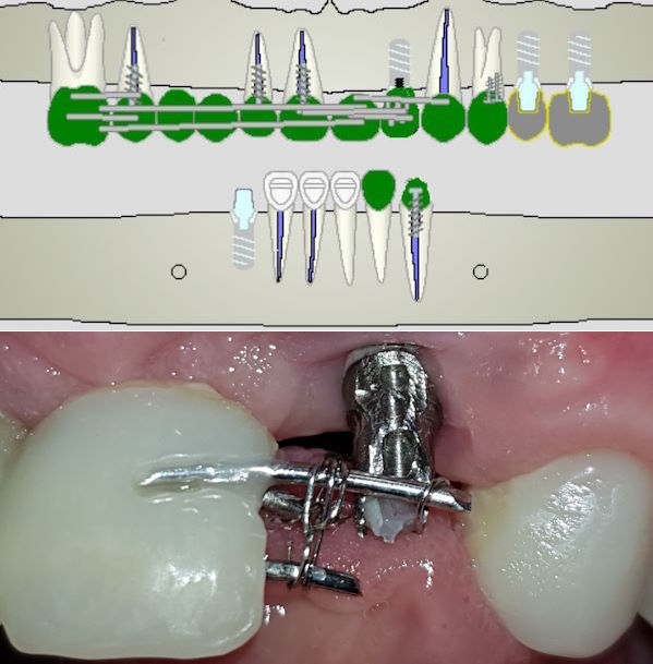 20Implantate7938.jpg