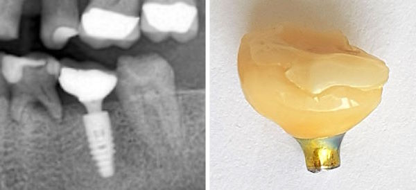 73_Implantat8900.jpg