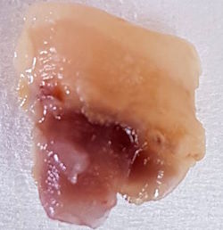 abgebrochener H&ouml;cker