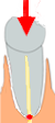 Pulpa