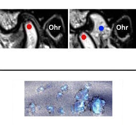 MRI Kiefergelenk