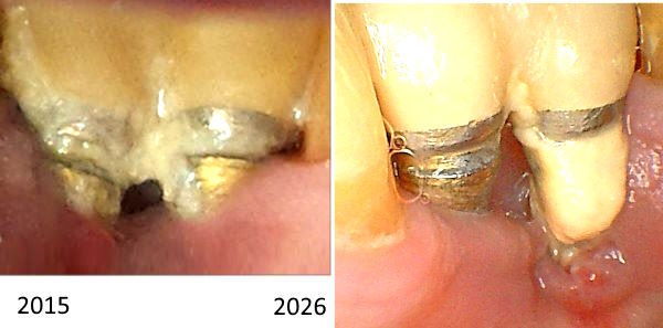 10Implantate6306.jpg