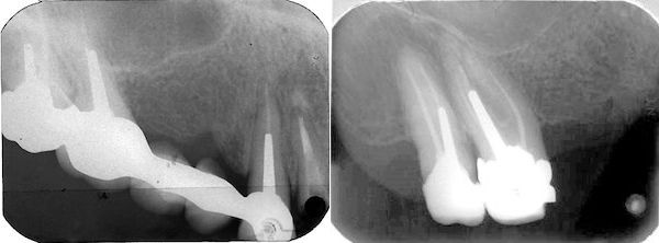 30Sinus1986.jpg