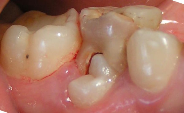 106MZ_5509.jpg
