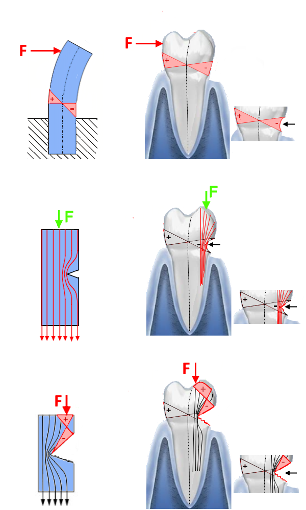 25LinienkorrosionTheorie.PNG